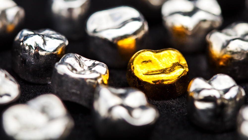 Cruz Dental Studio_Service_full-gold